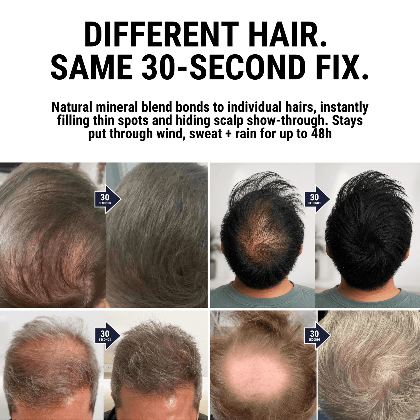 Densiq PRO - Hair Density Filler "Secret Offer" Buy 1 Get 1 Free