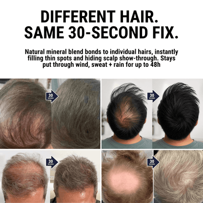 Densiq PRO - Hair Density Filler "Secret Offer" Buy 1 Get 1 Free