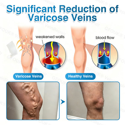 🇨🇦👨‍⚕️✅👍KLENIMORE™ VeinRepair Microneedle Patch Roll⚡Instant Relief, Long-Term Results