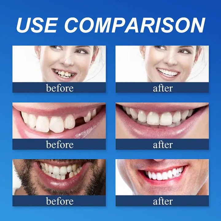 Ends Today: 75% OFF! ⏰KLENIMORE™ Medical Full Denture with Strong Suctiond Custom-Fit Full Functional Dentures🦷Obtain American Dental Association (ADA) Certification