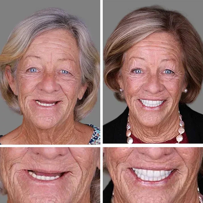 🏆Today's Special Offer 🏆2026 Bestselling Product🦷 Fit for a Fresh Smile, Say Goodbye to Wearing Discomfort!🌎