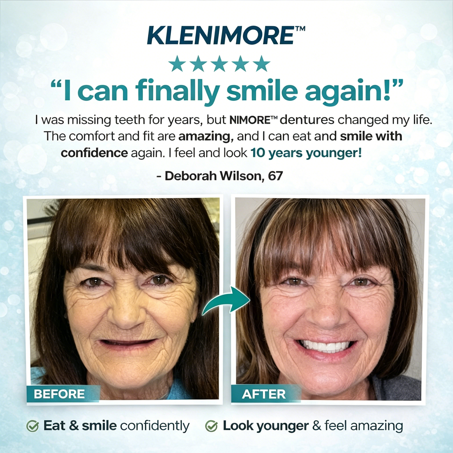 70% off! ⏰KLENIMORE™ Complete Dentures