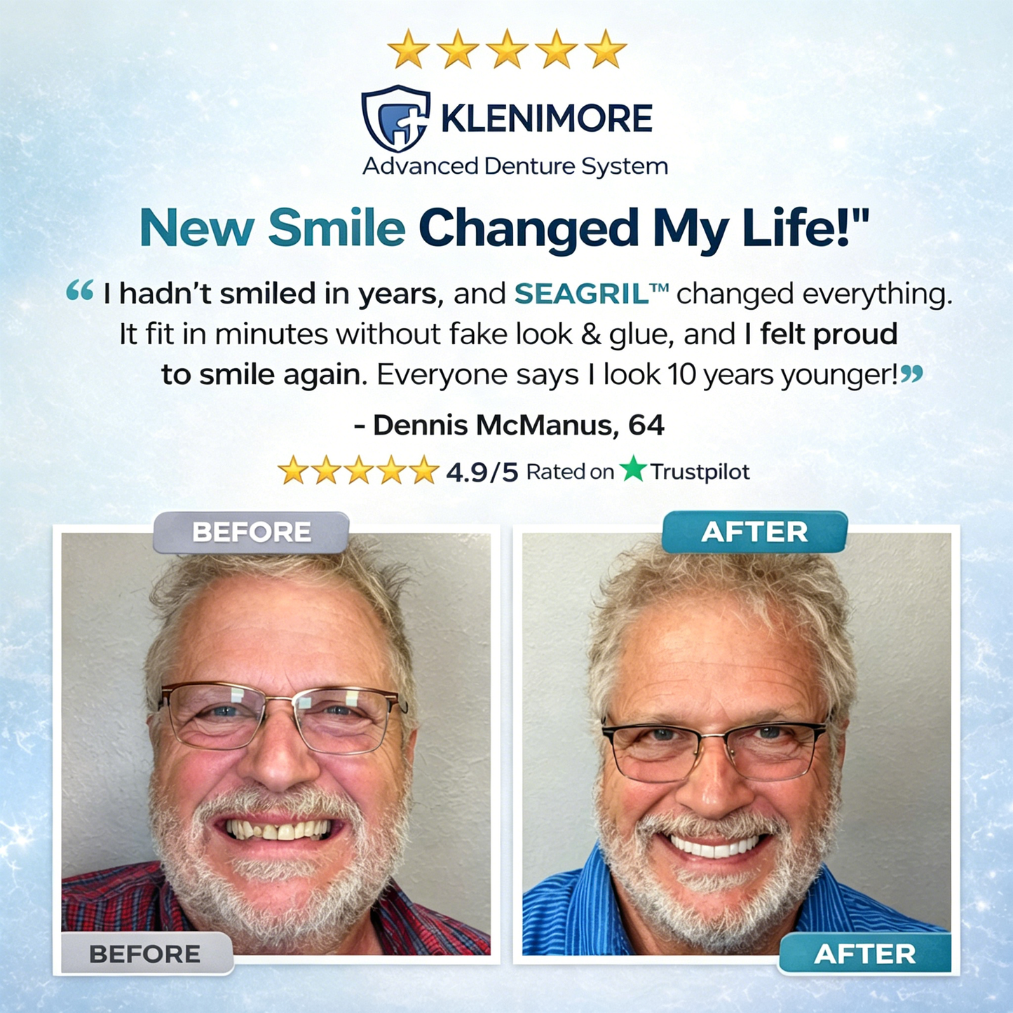 70% off! ⏰KLENIMORE™ Complete Dentures