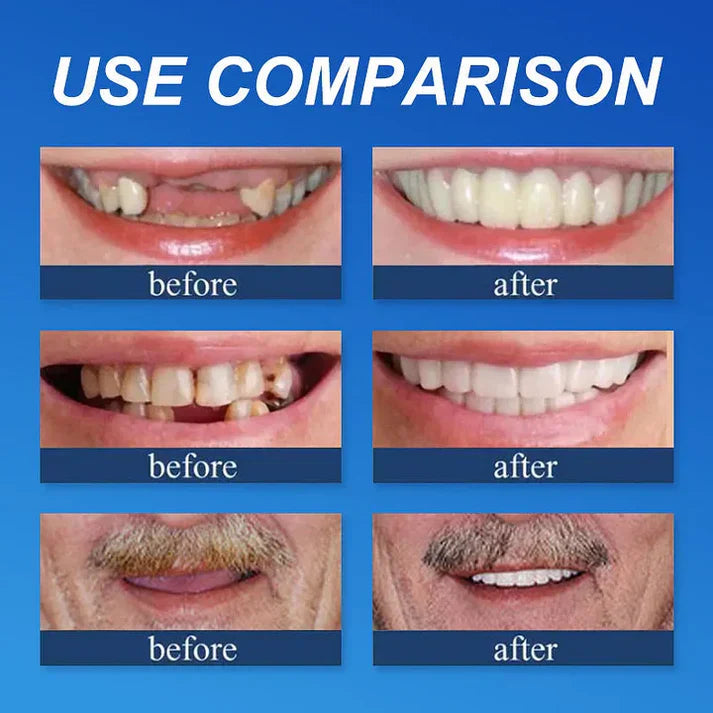 🏆Today's Special Offer 🏆2026 Bestselling Product🦷 Fit for a Fresh Smile, Say Goodbye to Wearing Discomfort!🌎